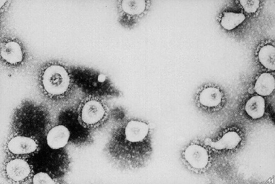 <p>ATLANTA, GA – UNDATED:  This undated handout photo from the Centers for Disease Control and Prevention (CDC) shows a microscopic view of the Coronavirus at the CDC in Atlanta, Georgia. According to the CDC the virus that causes Severe Acute Respiratory Syndrome (SARS) might be a “previously unrecognized virus from the Coronavirus family.”  (Photo by CDC/Getty Images)</p>