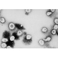 <p>ATLANTA, GA – UNDATED:  This undated handout photo from the Centers for Disease Control and Prevention (CDC) shows a microscopic view of the Coronavirus at the CDC in Atlanta, Georgia. According to the CDC the virus that causes Severe Acute Respiratory Syndrome (SARS) might be a “previously unrecognized virus from the Coronavirus family.”  (Photo by CDC/Getty Images)</p>